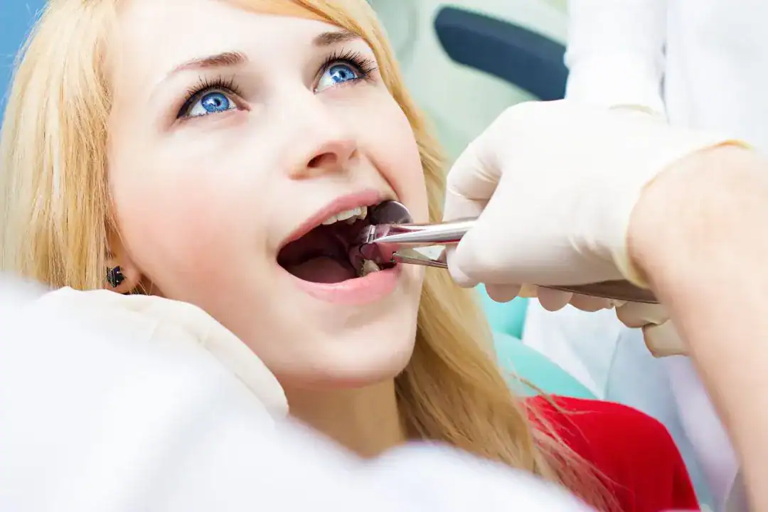 Tooth Extraction Penrith