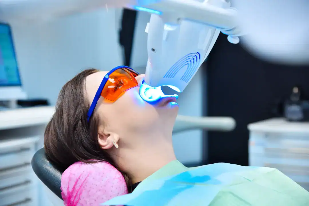 Teeth Whitening Penrith