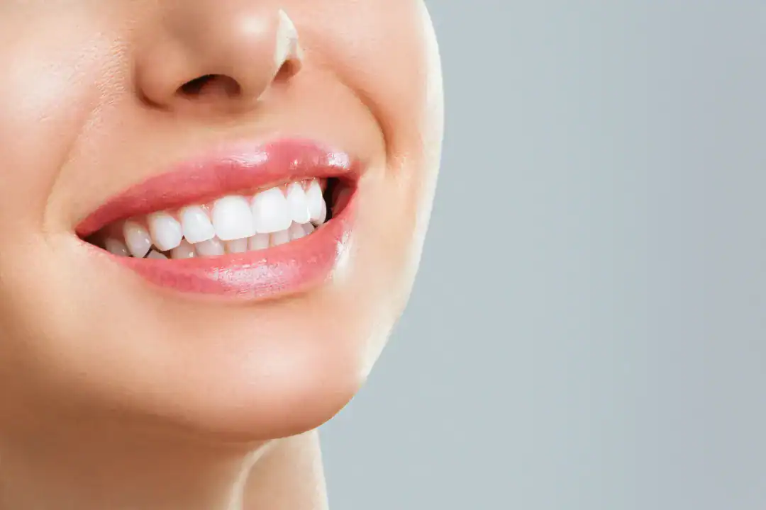 Teeth Whitening Penrith