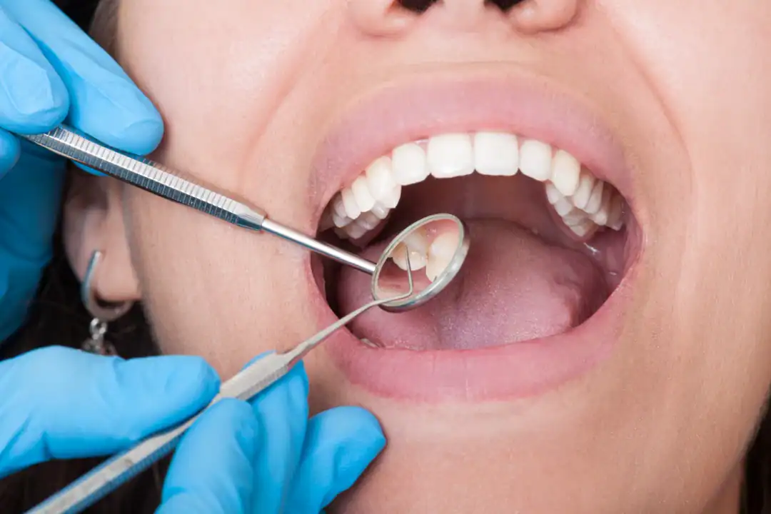 Dentist St Marys NSW