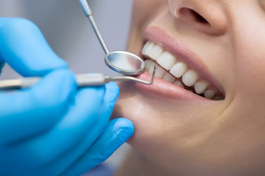 Teeth Cleaning Penrith