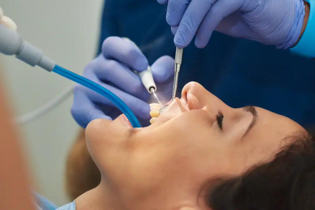 Teeth Cleaning Penrith